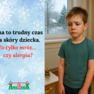 Więcej o: Zimowe problemy skórne u dzieci – kiedy to tylko efekt pogody, a kiedy sygnał alergii?