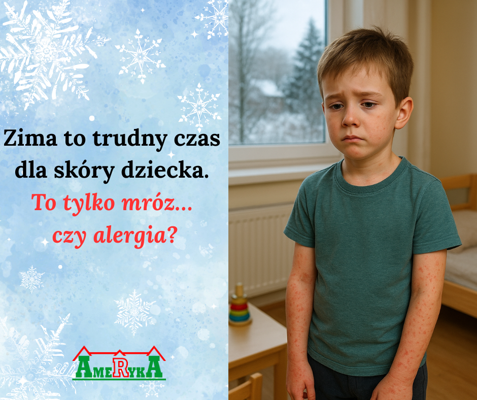 Grafika podzielona na dwie części. Po lewej stronie znajduje się niebieskie, zimowe tło ze śnieżynkami i napisem: 'Zima to trudny czas dla skóry dziecka. To tylko mróz… czy alergia?'. Na dole widoczne jest logo szpitala Ameryka. Po prawej stronie stoi chłopiec w dziecięcym pokoju, ubrany w krótki rękaw, z widoczną na rękach czerwoną wysypką i lekko smutną miną. W tle widać okno z zimowym krajobrazem.